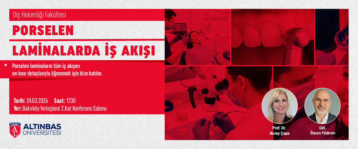 Porselen Laminalarda İş Akışı